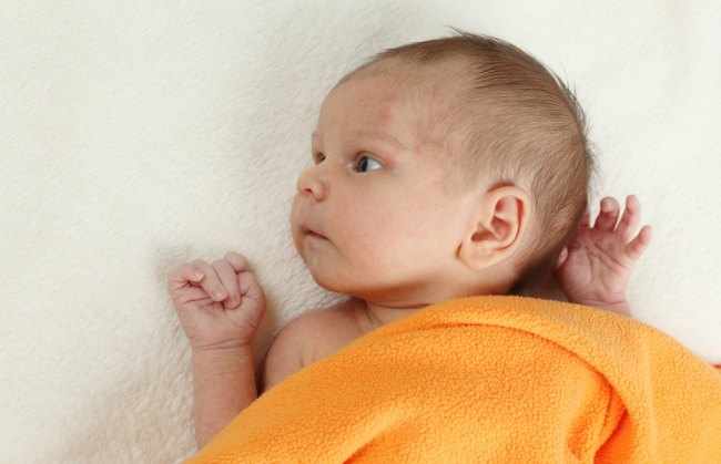 erupciones en la cara del bebe