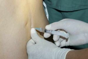 resolviendo las dudas sobre la epidural